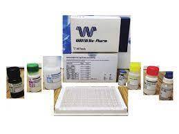WANTAI SARS-CoV-2 IgG ELISA (Quantitative